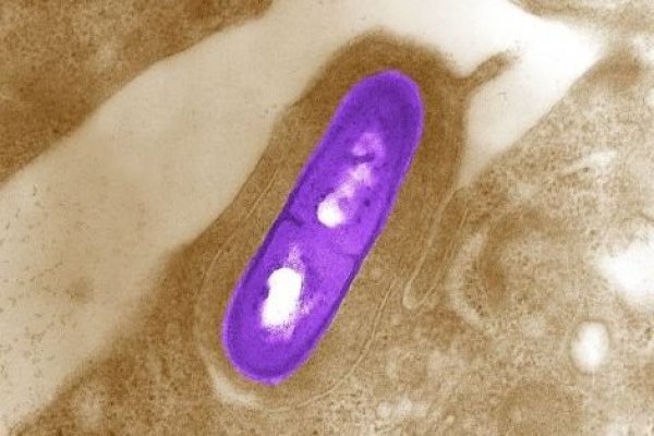 ¿Qué es la listeria? La bacteria resistente al frío y los desinfectantes detectada en la fruta chilena