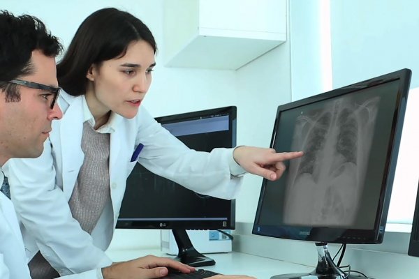Liberan software que permite detectar Covid-19 en radiografías de tórax en menos de un minuto