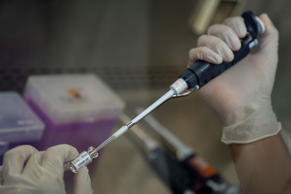 Pandemia pone urgencia a la creación de políticas públicas en I+D de vacunas en Chile