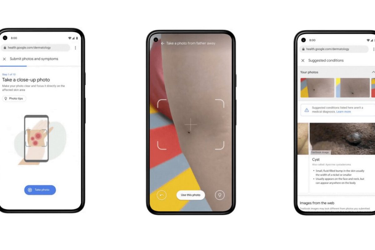 <p>Google mostró cómo será su futuro: cámaras podrán detectar hasta cáncer en la piel</p>
