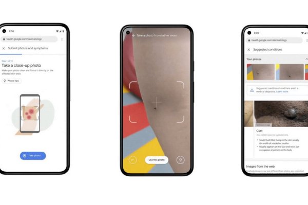 Google mostró cómo será su futuro: cámaras podrán detectar hasta cáncer en la piel