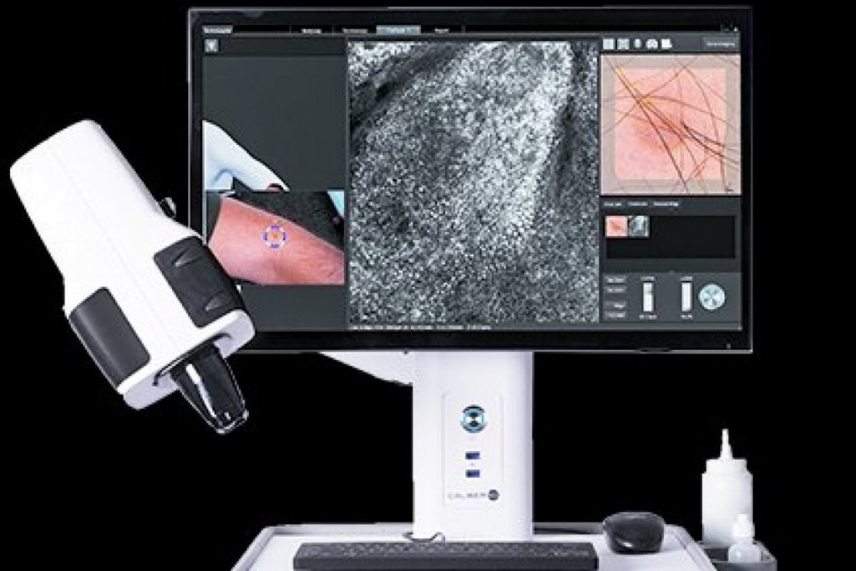 <p>Las nuevas tecnologías conectadas a IA para tratar melanomas, diabetes y salud mental</p>