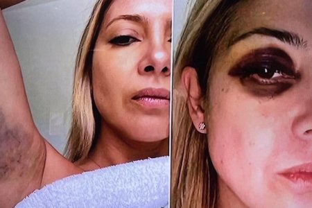 <p>Revelan duras imágenes y diálogos en denuncia por violencia de género presentada por expareja de Alberto Fernández</p>