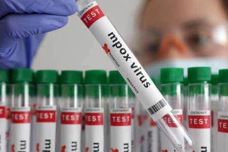 <p>Argentina activa protocolo de emergencia por caso de “viruela del mono” en barco carguero de Brasil</p>