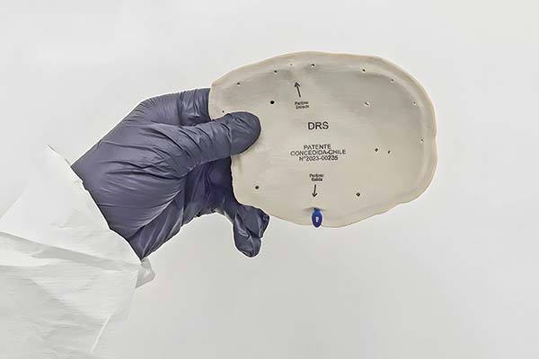 Implante craneofacial impreso en 3D con sistema de liberación de fármacos.