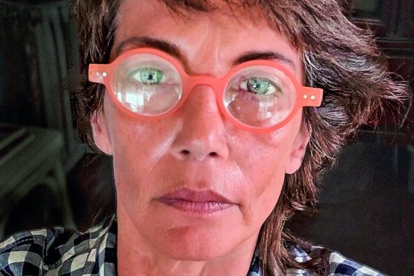 Fotógrafa Pin Campaña y la salud frágil: “Yo ya me acostumbré al dolor”