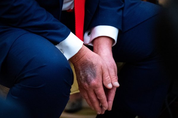 <p>El mandatario suele disimular con maquillaje los moretones en sus manos y decoloración en su cuello. (Foto: Bloomberg)</p>